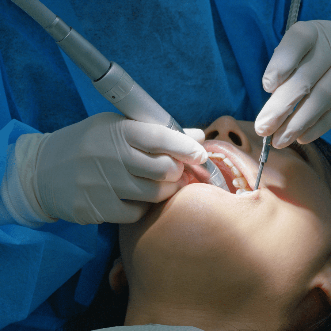 Cirugía Oral y Maxilofacial - Dénitca by Cristina Suaza